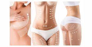 Miami’s Secret to a Flawless Midsection: Tummy Tuck Magic post thumbnail image